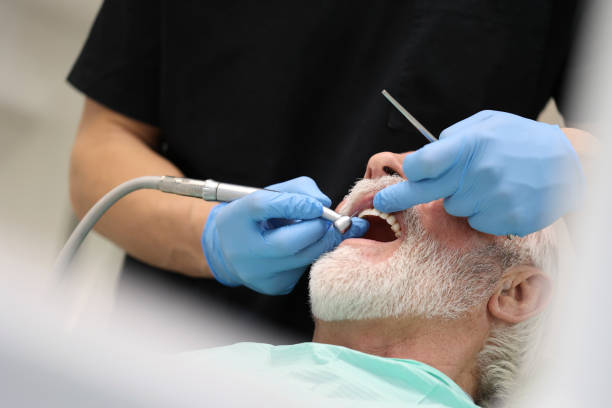 Oral Cancer Screening in Oak Harbor, WA